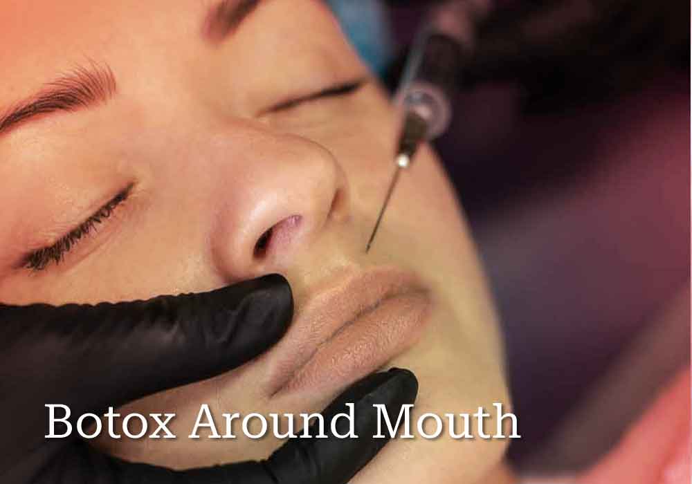 Botox Around Mouth-Say Goodbye to Wrinkles (Does it Work?)