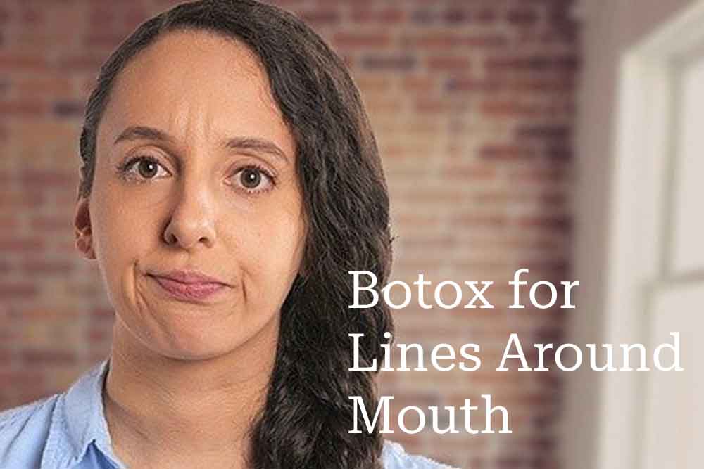 Botox for wrinkles around mouth