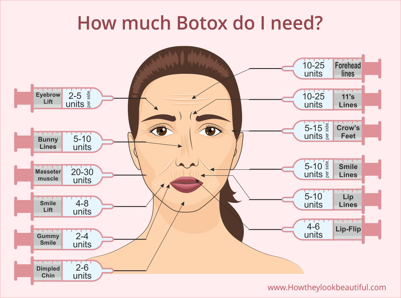 Botox Infographic-How much Botox do I need ?