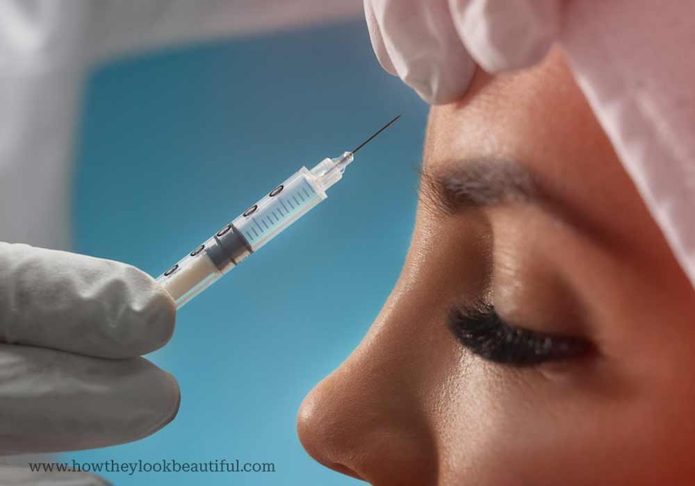 botox for forehead wrinkles