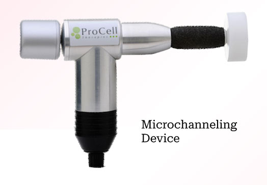 Microchanneling device